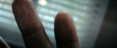 [Faraday] Adermatoglyphia.
That's what they call it here. - The Man Who Fell to Earth