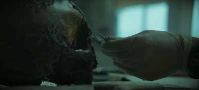 For example, if you measure
the distance between the eyes, - The Chemistry of Death