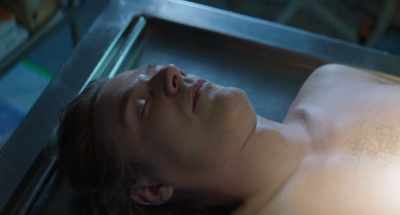 FORENSIC CAUSE: - Anatomy of a Fall
