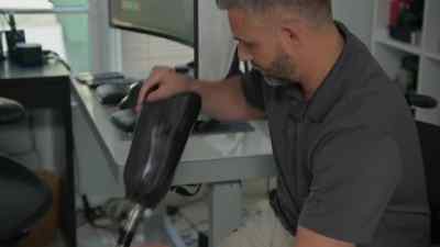 FOREST: The accident
happened two years ago. - Cesar Millan: Better Human, Better Dog