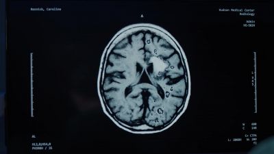 Found the source
of the bleed. - The Good Doctor