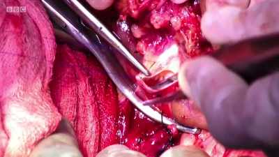 Four o'clock. - Surgeons: At the Edge of Life