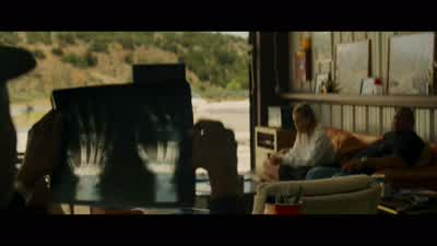 Fractured fourth and fifth metacarpals. - Creed III