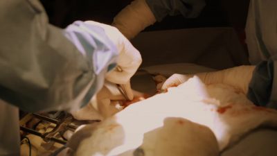 Freeing up the vein. - The Good Doctor
