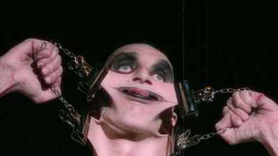 - Gary Turner has
Ehlers-Danlos syndrome. - The UnBelievable with Dan Aykroyd