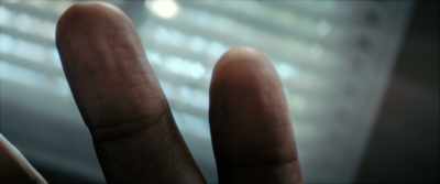 Genetic transversion
expressed in the skin, - The Man Who Fell to Earth