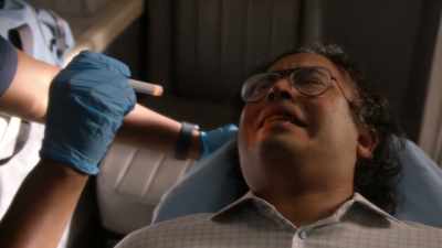 Gingival hyperplasia - 9-1-1