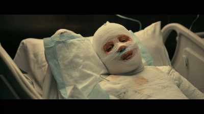 Given the damage to her lung,
she'll need to remain on oxygen. - The Fall of the House of Usher
