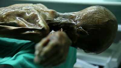 GOETZ: Otzi Man comes from
a farming community - Origins: The Journey of Humankind