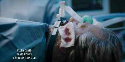 Good morning, everyone. - Transplant