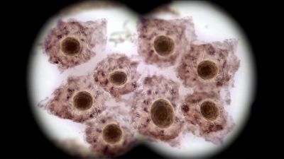       GREG:
    Okay, epithelials
         are an affirmative. - CSI: Crime Scene Investigation