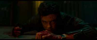 [groans] - Novocaine