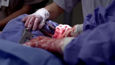 Guys, you lost her. - Grey's Anatomy