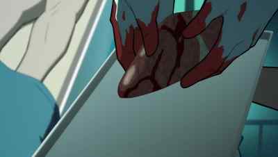Half the liver,
one kidney, the spleen. - Superman: Man of Tomorrow