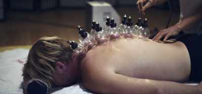 Have Chinese herbs,
get cupping. Crazy suction. - Root Cause