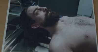 He had a bash
to the back of the head, - Acceptable Risk