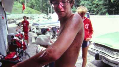He had abrasions all
up and down his body - Shadow of a Wheel