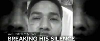 He was brutally beaten by attackers - Uncle Tom