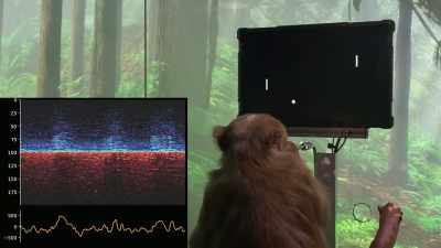 He is creating a chip that
can be put into our brains. - The Elon Musk Show