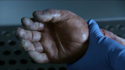 He has got symmetrical
scars on both palms. - CSI: Crime Scene Investigation