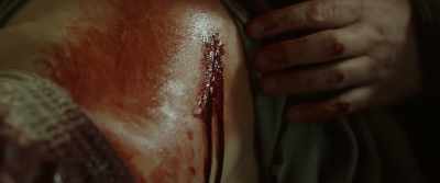 He hurt me. - Bull