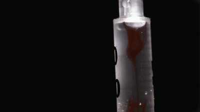 He injects them with this
morphine, he's addicted to it. - 35 Serial Killers the World Wants to Forget