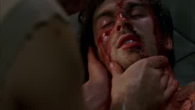 He needs blood. - Lost