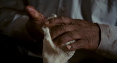 He said you need some stitches honey - Babel