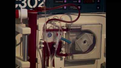 He then started on dialysis, - Gary