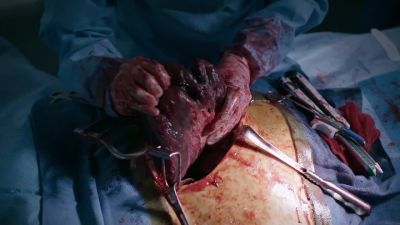 Heart rate
and temperature normalizing. - The Resident