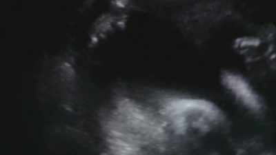 [HEARTBEAT] - One Child Nation