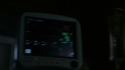 Hemodynamics are stable. - Teen Wolf