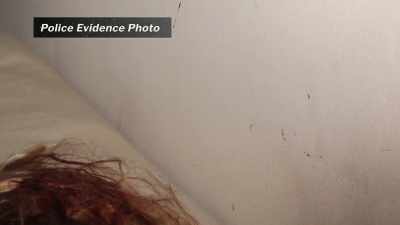 Her hair was fairly
blood-soaked. - Final Moments