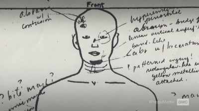Her teeth were loose. - The Preppy Murder: Death in Central Park