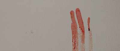 Her throat had an extremely deep wound. - Amanda Knox