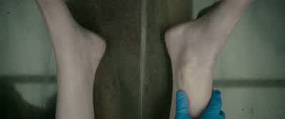 Her wrists and ankles are fractured. - The Autopsy of Jane Doe