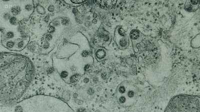 Here, these two are viruses - Secrets of Size: Atoms to Supergalaxies