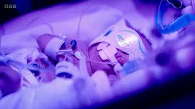 He's being fed intravenously. - The Human Body: Secrets of Your Life Revealed