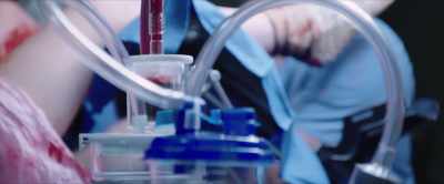He's perforated the uterus, - Unplanned
