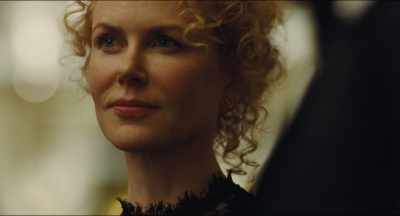 - High GGTs and elevated transaminases.
- GUEST : Oh, good on you - The Killing of a Sacred Deer