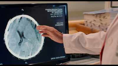 His brain experienced
so much pressure and irritation - The Meyerowitz Stories