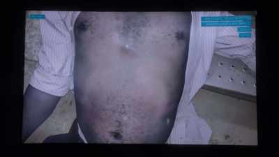 His heart was missing, but
there was no incision. - Ghosted