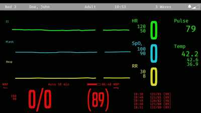 (hospital machine flatlining) - Interrogation Raw