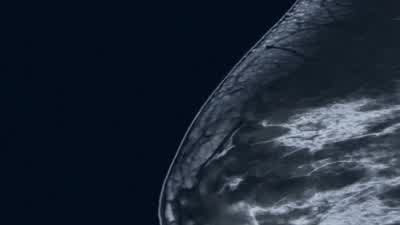 House: No tumor? - House