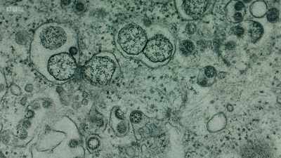 How have electron microscopes
allowed us to understand Covid-19? - Secrets of Size: Atoms to Supergalaxies