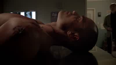 How's our patient? - Teen Wolf
