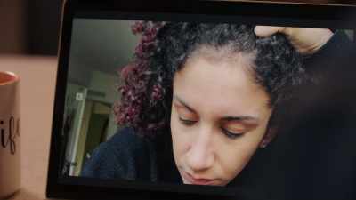 I had a few breakouts,
like an allergic reaction - Not So Pretty