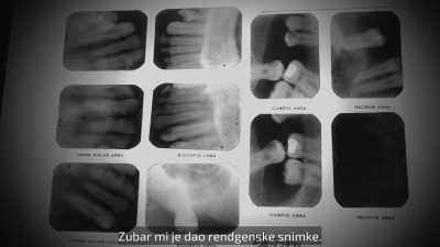I was able to obtain x-rays
from that doctor, - Night Stalker: The Hunt for a Serial Killer