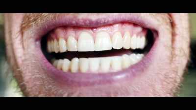 I always tell my 
canines were from me - What the Health