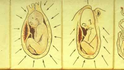 I call them perinatal matrices,
basic perinatal matrices. - The Way of the Psychonaut